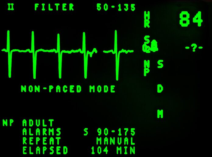electrocardiogram 16948 1280